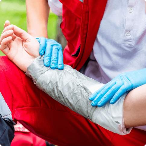Burn Injuries
